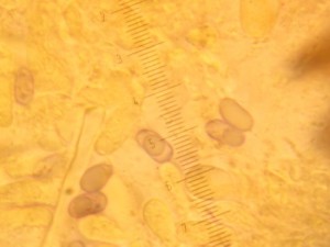 Spores amyloïdes